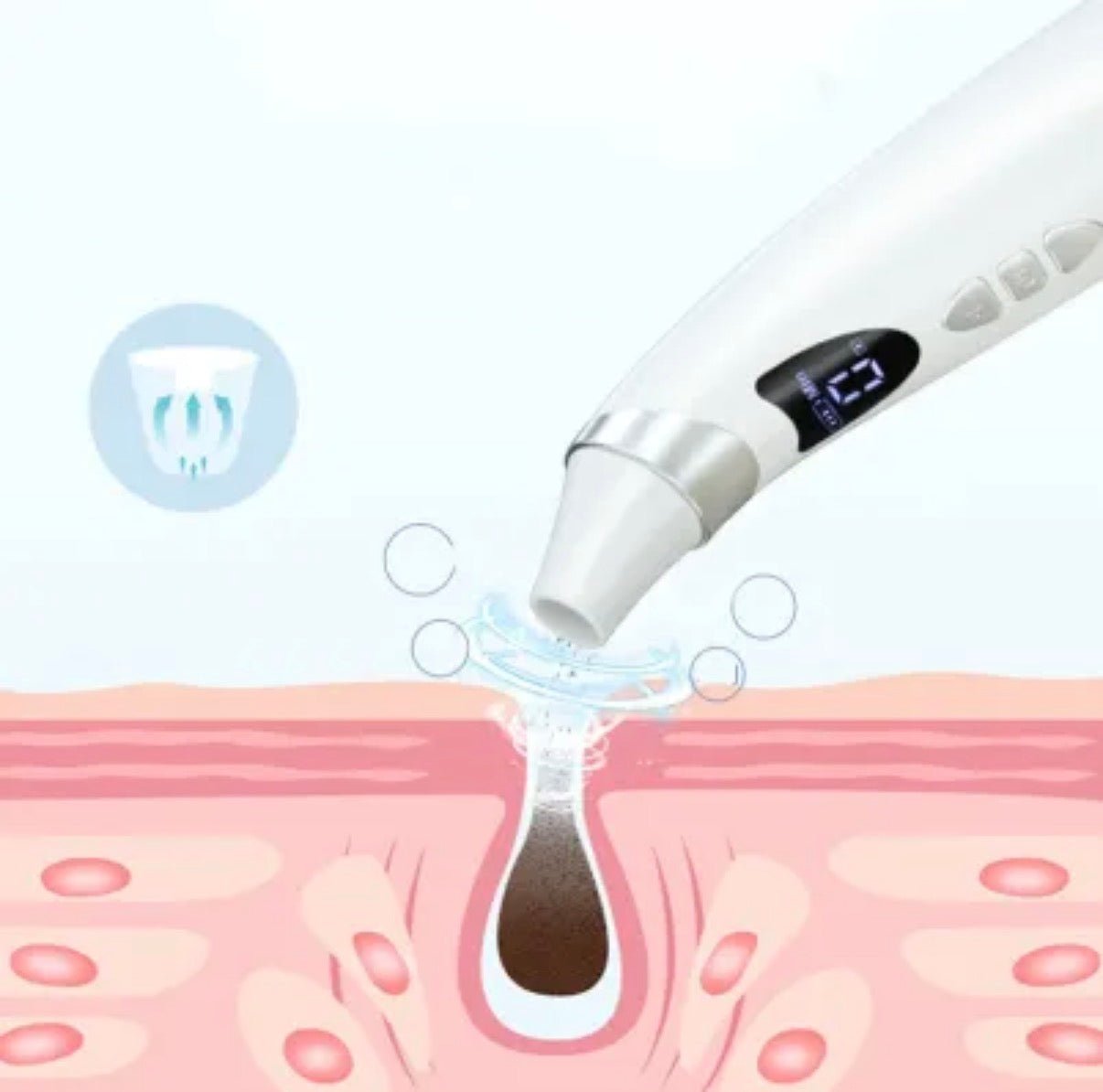 Mitesser - Entferner - Averod